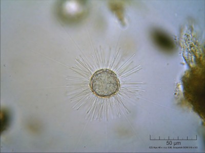 acanthocystis turfacea A 40x.jpg