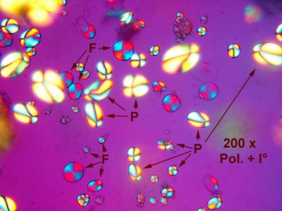 Amido di patata P e di frumento F in luce polarizzata, compensata in I° ordine.