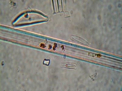 diatomea100x.JPG