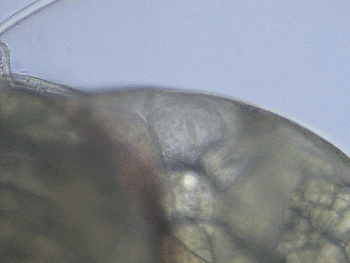 embrione di gasteropode