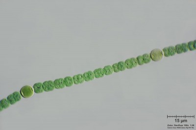 anabaena-eterocosti 100x.JPG