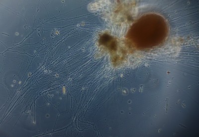 La fittisssima e intricata rete degli pseudopodi anastomizzati Ob. Zeiss Achroplan Cdf 20x