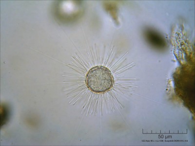 acanthocystis turfacea A 40x.jpg
