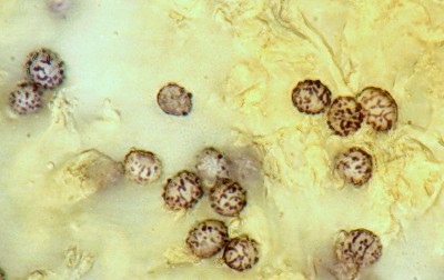 Spore di Russula sp. in Melzer su lamella.