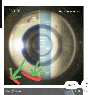 Foto aperturometro del Prof. Sini - riprodotto senza autorizzazione, e probabilmente lui non sarà affatto contento