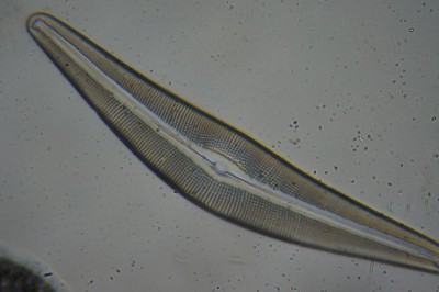 Obiettivo 40x, diatomea Cymbella sp.