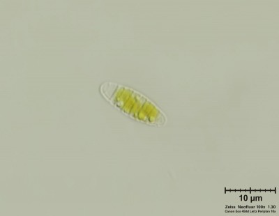 4-Diatoma mesodon-3-2013-b_100x.JPG