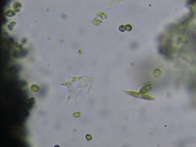 ameba-diatom.JPG