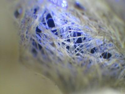 le pareti del nido in epi/diascopia